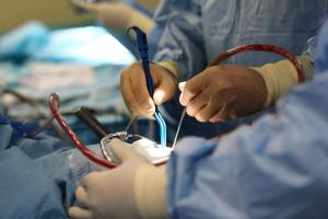 удаление опухоли мозга